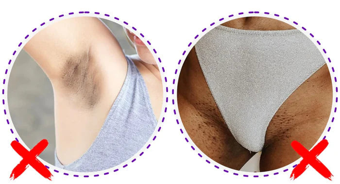Laser Flex - Removedor de Pelos Elétricos