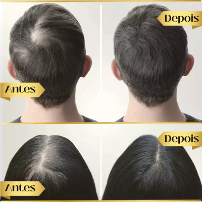 Tônico Capilar Repair Hair® | Crescimento Capilar e Combate à Queda de Cabelo 